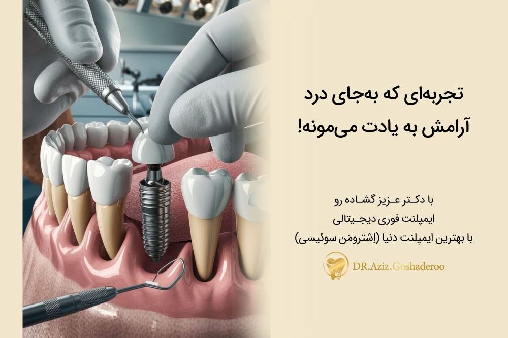 مرکز ایمپلنت دندان در تهران